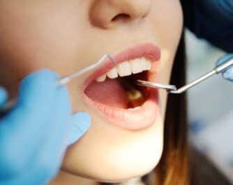 Dentista Ghiazza Dr. marco Torino